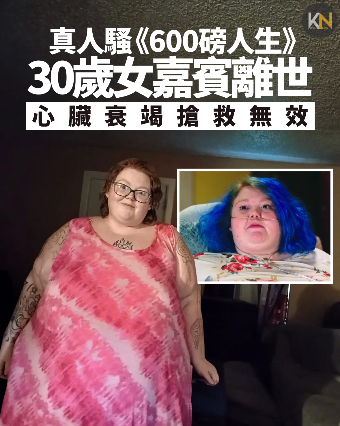 真人騷《600磅人生》30歲女嘉賓離世 心臟衰竭搶救無效