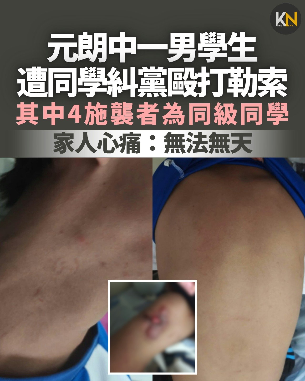 元朗中一男學生 遭同學糾黨毆打勒索 家人心痛：無法無天