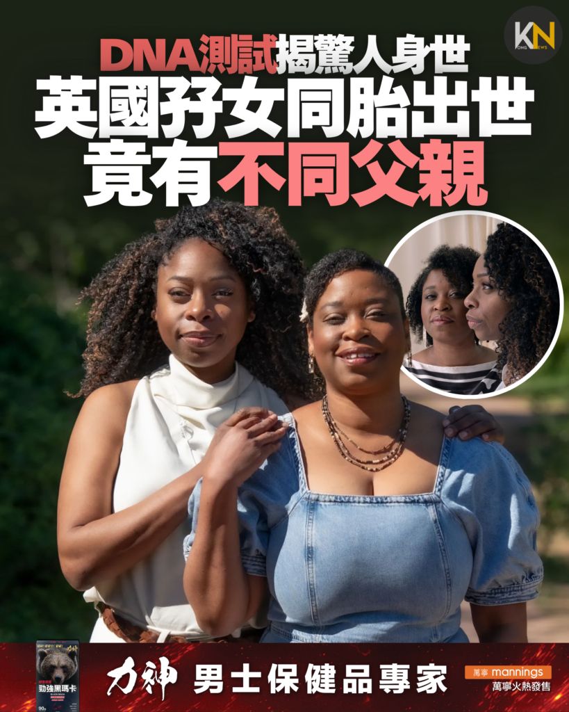 DNA測試揭驚人身世 英國孖女同胎出世 竟有不同父親