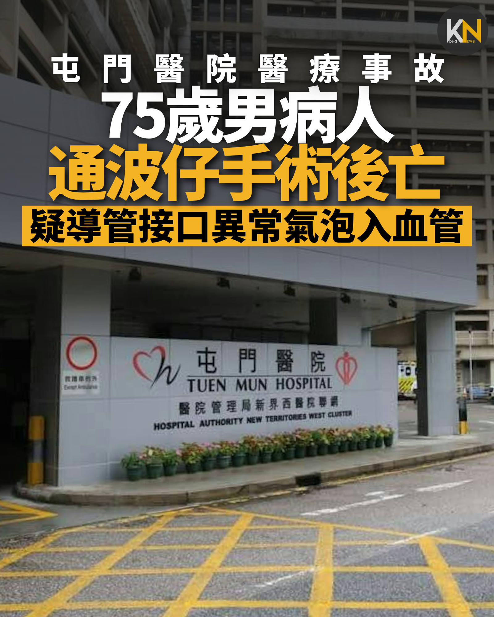 屯門醫院醫療事故 75歲男病人通波仔手術後亡疑導管接口異常氣泡入血管