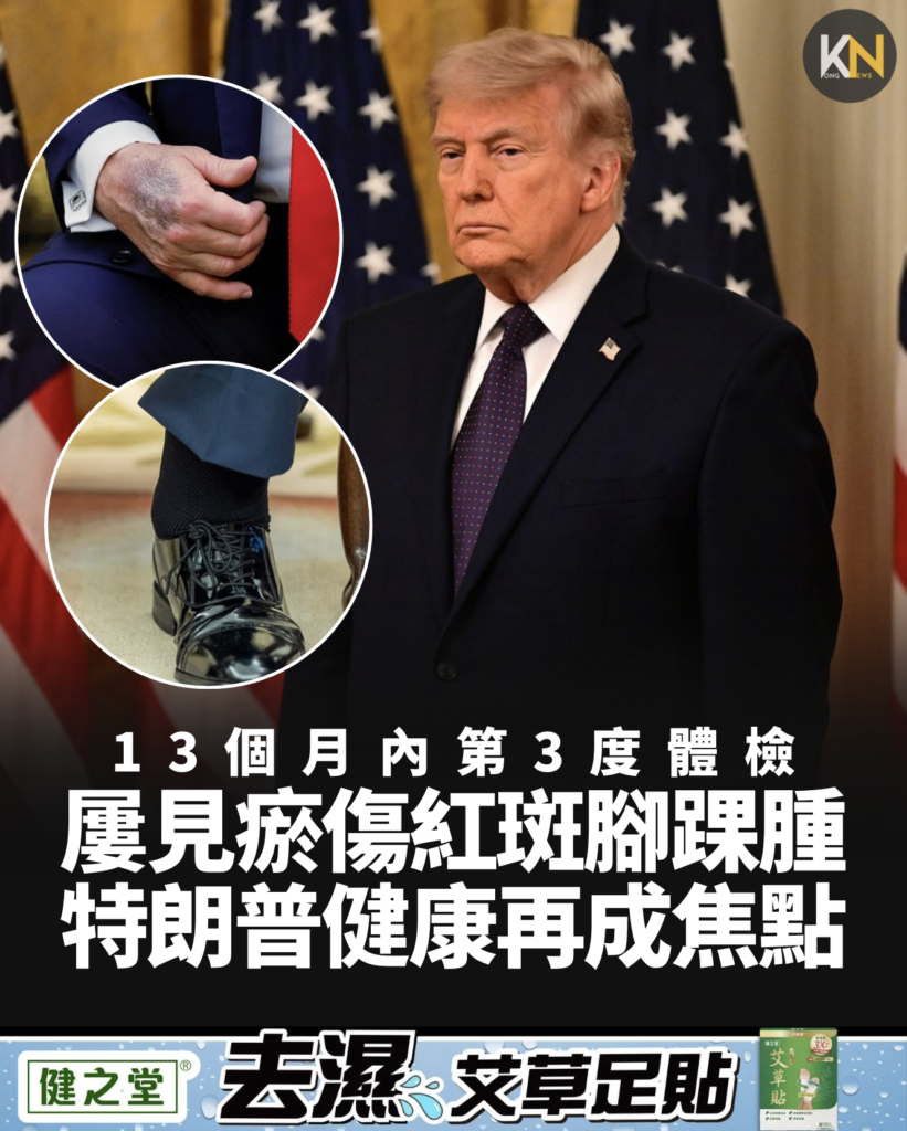 13個月內第3度體檢屢見瘀傷紅斑腳踝腫特朗普健康再成焦點