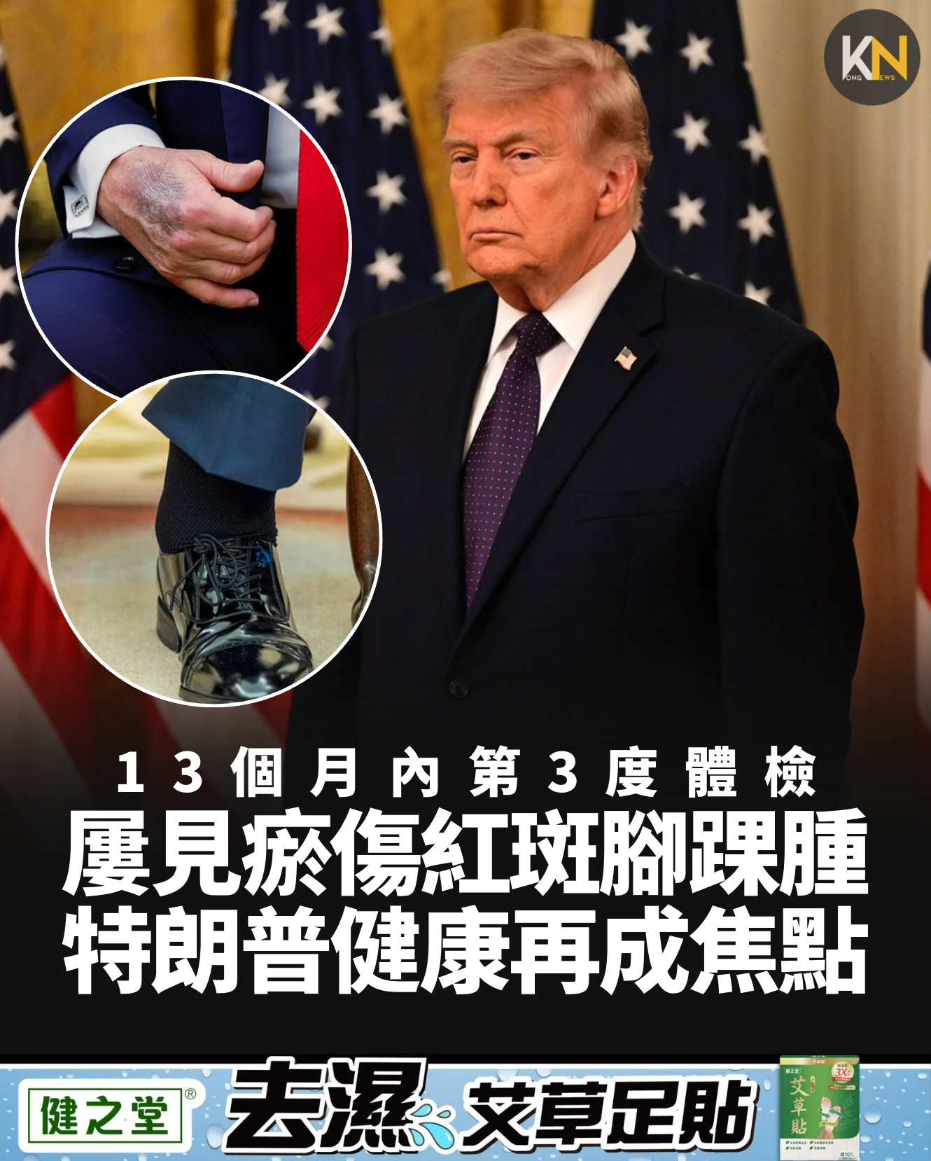 13個月內第3度體檢屢見瘀傷紅斑腳踝腫特朗普健康再成焦點